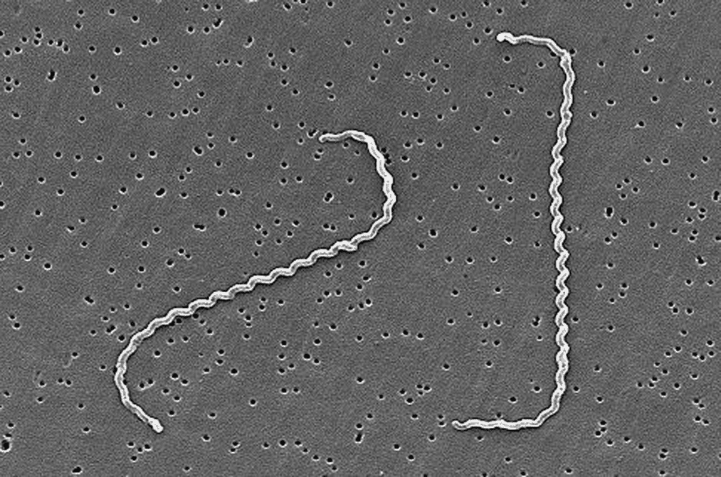 Leptospira interrogans