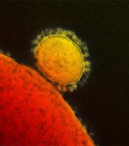Coronaviruses and Animals - what's the risk?