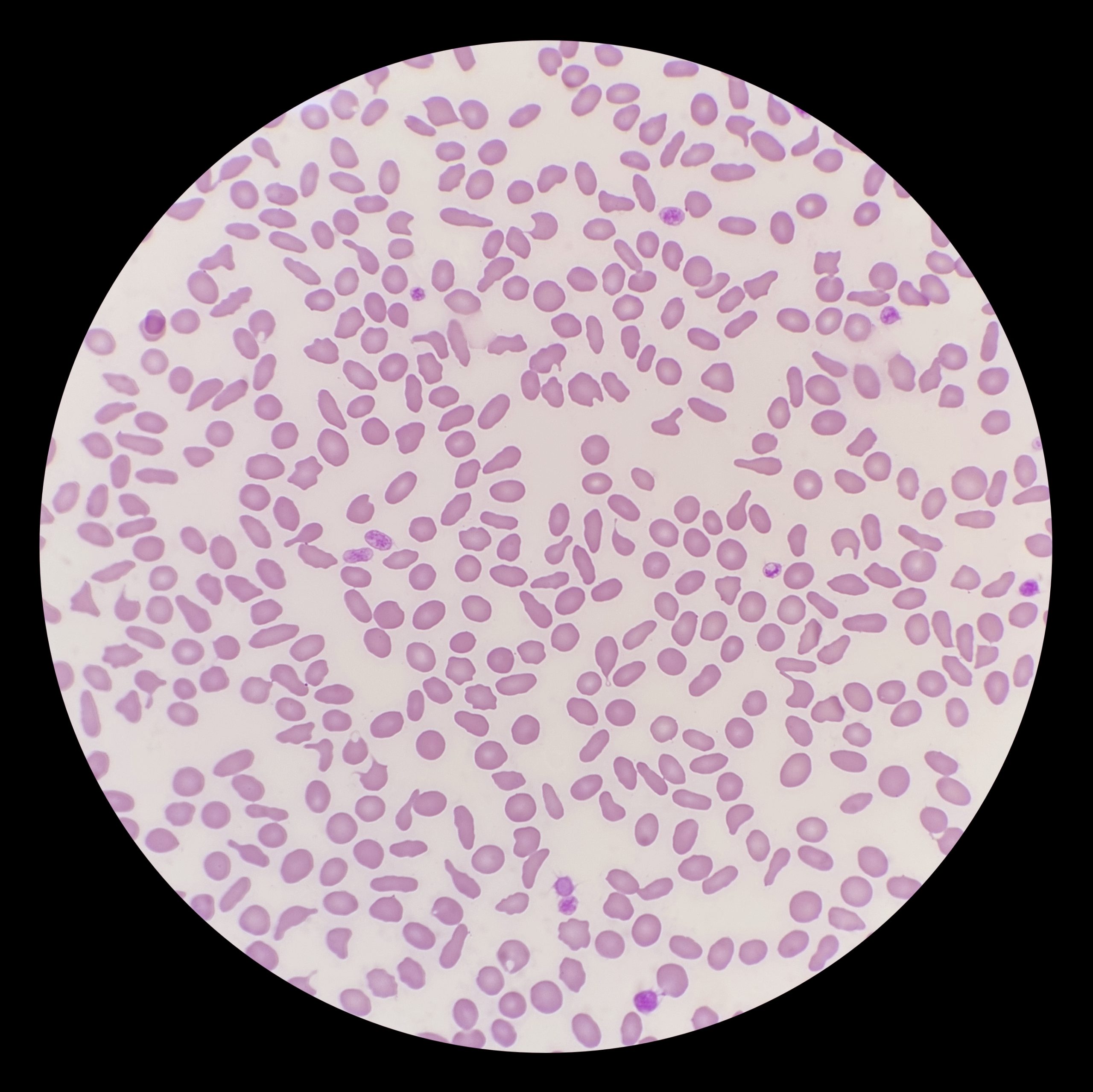 Blood smear from a cat with anaemia