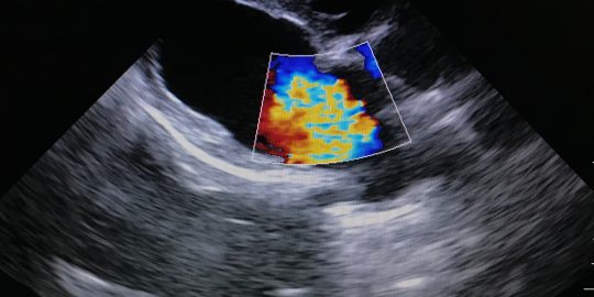 Dog heart scan showing mitral valve regurgitation
