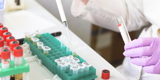 Serum tubes being loaded with pipette in laboratory